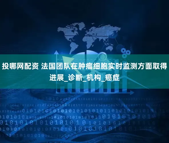 投哪网配资 法国团队在肿瘤细胞实时监测方面取得进展_诊断_机构_癌症